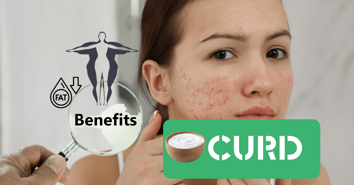 2 Benefits of Curd for Acne-Prone Skin and Fat Loss