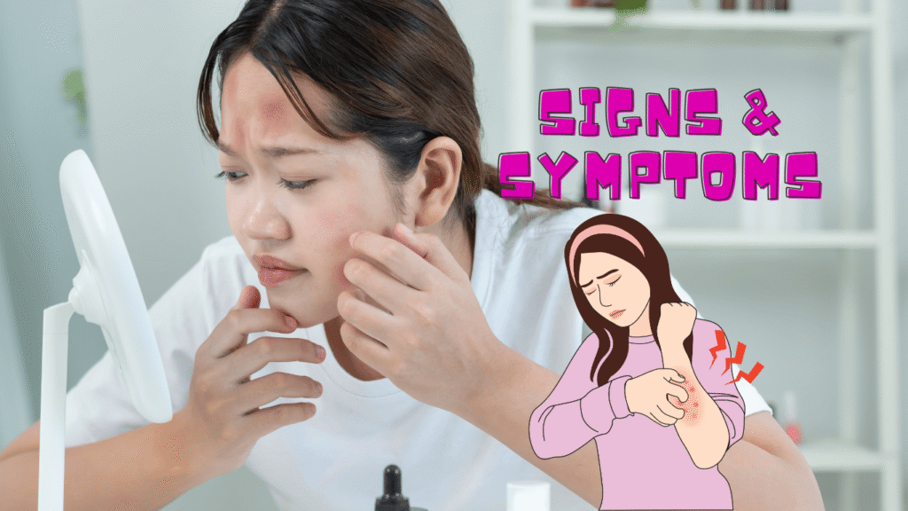 signs & symptoms of Contact Dermatitis