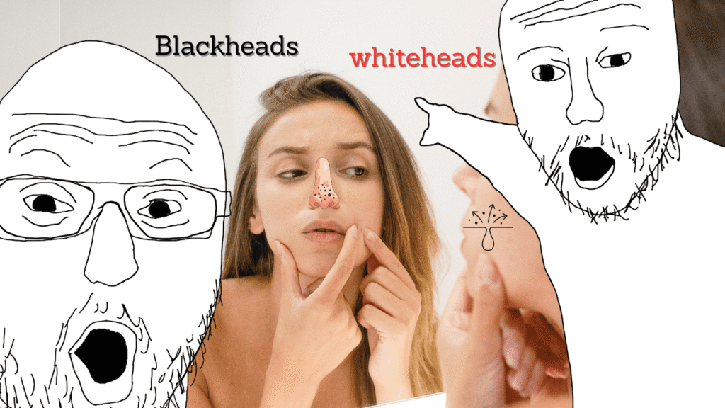 Blackheads and Whiteheads